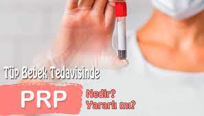 tup bebekte prp tedavisi nedir yararli mi