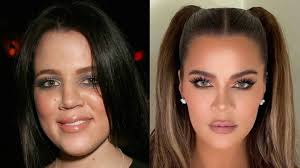 Born june 27, 1984) is an american media personality, socialite, and model. 3 Changes On Khloe Kardashian S Face After She Shared A New Look On Instagram Westside Face