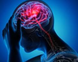 Immagine di Trauma cranico