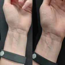 You see a mixture of both warm and cool tones. Trying To Figure Out My Undertone Pics Had Slightly Different Light So I M Posting Both I M Having A Hard Time Telling Vein Color So I Can T Tell Undertone Thanks Skincareaddicts