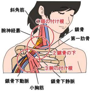 その手の痺れ、原因は首ではない？】胸郭出口症候群の症状と治療法について｜たけだ整骨院
