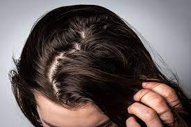 How To Reduce Oil On Your Scalp | Blog | Keranique