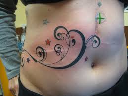 Stretch mark tattoos are a creative way of camouflaging those scars. Tattoo To Hide Keloid Scars Tattoo Design