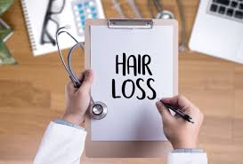 How rapid was the hair loss? Advanced Hair Growth Clinic