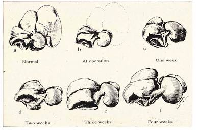 Chronological schematic of liver mass restoration following 70% partial hepatectomy (a-f), demonstrating compensatory lobular growth over a four-week period., AI generated