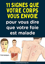 We did not find results for: 46 Meilleures Idees Sur Guerison De Thyroide En 2021 Thyroide Hypothyroidie Tyroide