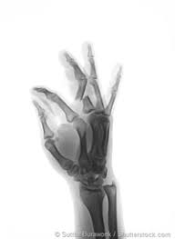 Douleur de la main le figaro santé. Causes De Douleur De Main