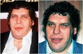 Andre The Giant S Height Weight He Was Since The Very Childhood