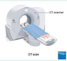 Ct Scan Health Information Bupa Uk