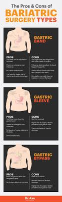 The Pros Cons Of Bariatric Surgery Healthier Alternatives Dr Axe Bariatric Bariatric Surgery Gastric Sleeve Diet