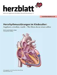 Typisch sind zum beispiel herzrasen, herzstolpern, schwindel, schwäche, brustschmerzen, atemnot, leistungsabfall, sehstörungen oder ein aussetzen des pulses. Herzrhythmusstorungen Symptome Ursachen Und Behandlung Herzstiftung
