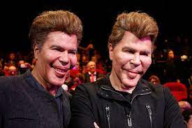 Twins Bogdanoff Plastic Surgery Celebrity Plastic Surgery Plastic Surgery Gone Wrong