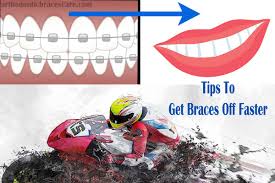 You can use either a cotton swab or your finger to apply it. How To Get Braces Off Faster Orthodontic Braces Care
