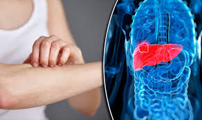 A painless lump in the abdomen. Liver Cancer Symptoms Nine Signs You Could Be Suffering With Disease Express Co Uk