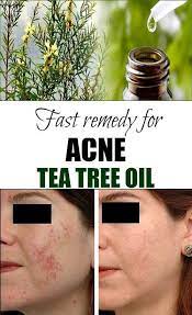 Pin On Warts Medicine