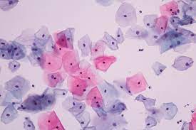 The linksys pap2 is a reliable inexpensive telephone adapter that works with the callcentric service when placed behind your broadband internet router. Testul Babes Papanicolau Pap Cand Este Recomandat Si Ce Indica Reginamaria Ro