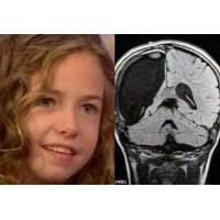 Impian Bocah Berotak Sebelah Menjadi Balerina