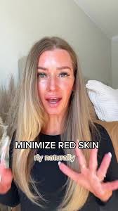 How to Cocer A Face Burn without Makeup