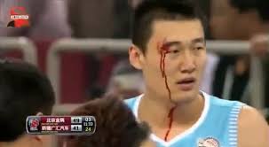 Randolph Morris Gets Nasty