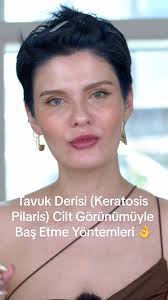 Kısa Gövde Uzun Bacak