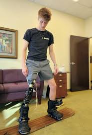 Profile for Scott Sabolich Prosthetics Ottobock.care