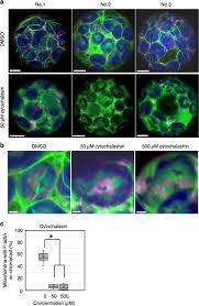 Maybe you would like to learn more about one of these? Mitochondrial Movement During Its Association With Chloroplasts In Arabidopsis Thaliana Communications Biology