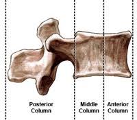 Broken vertebrae could also hurt. Types Of Spinal Fractures