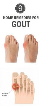 9 Best Home Remedies For Gout Hugestyles Home Remedies For Gout Gout Remedies Home Remedies