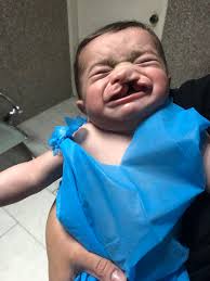 آل ڪآتب و آل آع ل آمي ف آر س آل ع ب يد ي on twitter والله العظيم والله على مااقول شهيد وانا شاهد عيان بصفتي الراعي الرسمي الحاله اليوم كان من المفترض ان تقام عمليه الطفل عز الدين ولكن كونه
