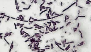 Image result for Anthrax