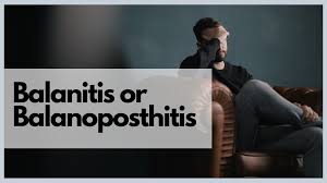 Image result for balanoposthitis