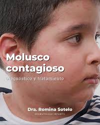 🦠 𝗠𝗼𝗹𝘂𝘀𝗰𝗼 𝗰𝗼𝗻𝘁𝗮𝗴𝗶𝗼𝘀𝗼