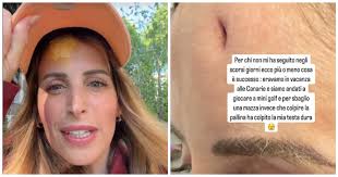 Una mazza da minigolf ha colpito la mia testa al posto della pallina. Ho un  taglio che ha raggiunto l'osso”: il racconto di ClioMakeUp