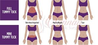 How to get rid of a fupa in a week. What Can I Do About My C Section Scar And Pooch Tannan Plastic Surgery Raleigh Chapel Hill Durham Nc