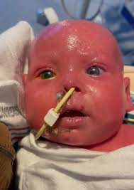 Avery's Story (@averysstoryfb) • Facebook