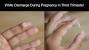 Black Woman Yeast Infection Symptoms