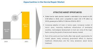 In 2017, multiple hernia mesh class action lawsuits were brought against johnson & johnson, atrium, and other manufacturers, though the outcomes. Hernia Repair Market By Product Type Geography Covid 19 Impact Analysis Marketsandmarkets
