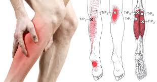 Here S A Simple Home Remedy For Restless Leg Syndrome Everyone Swears By Rusteloze Benen Syndroom Spierpijn Gezondheidsfitness