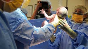 I had my plif of l5/s1 done a year back. Studies Confirm Uninsured Rates Impact Those With Insurance In Cost And Access Healthcare Finance News