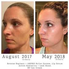 Hi fam. I am having challenges with my skin the cold weather in the morning  plus I work in an open field, the sun during the day awe sure I have become