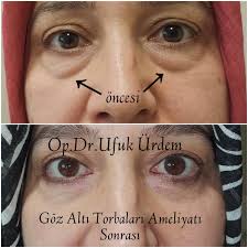 Op Dr Ufuk Urdem Photos Facebook