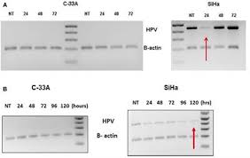 Yadda ake tsara tsara akan reddit. Frontiers From Bench To Bedside Evaluation Of Ahcc Supplementation To Modulate The Host Immunity To Clear High Risk Human Papillomavirus Infections Oncology