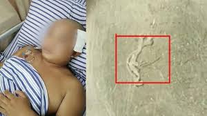 Cacing pita kini merajai seluruh berita kesehatan di belahan dunia. Cacing Hidup Dalam Otak Pria Ini Selama 17 Tahun Akibat Konsumsi Makanan Ini Sampai Badan Mati Rasa Halaman All Serambi Indonesia