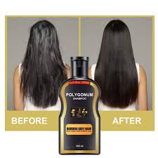 How do i eliminate gray hair naturally? Hair Darkening Shampoo Natural Darkening Shampoo Reverse Gray White Hair Gentle Hair Wash Ginger Shampoo Non Irritating Coloring Prevent Hair Loss Restore Lustrous And Shiny Hair Shampoo Buy Online In Antigua And