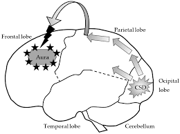 Baca manhwa that mans epilepsy bahasa indonesia akankah perjaka ini bisa mengimbangi pasangannya yang berpengalaman? Ijms Free Full Text Migraine Calcium Channels And Glia Html