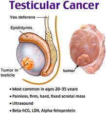 It's important to be aware of what feels normal for you. Why Young Men Should Care About Testicular Cancer Hudson Valley Press