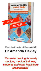 Sample request for medical professionals. Dermatology Made Easy Dermnet Nz