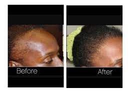 Hair Growth Secrets Using Natural Remedies For Longer Hair Natural Hair Growth Tips Hair Growth Faster Hair Growth Secrets