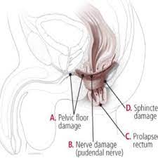 Pdf Anal Sphincter A Comprehensive Review