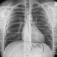 Global offensive has become a huge name in the esport world. Pin By Feslacg On Polora Medical Knowledge X Ray Xray Tech